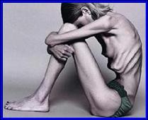 anorexia.jpg